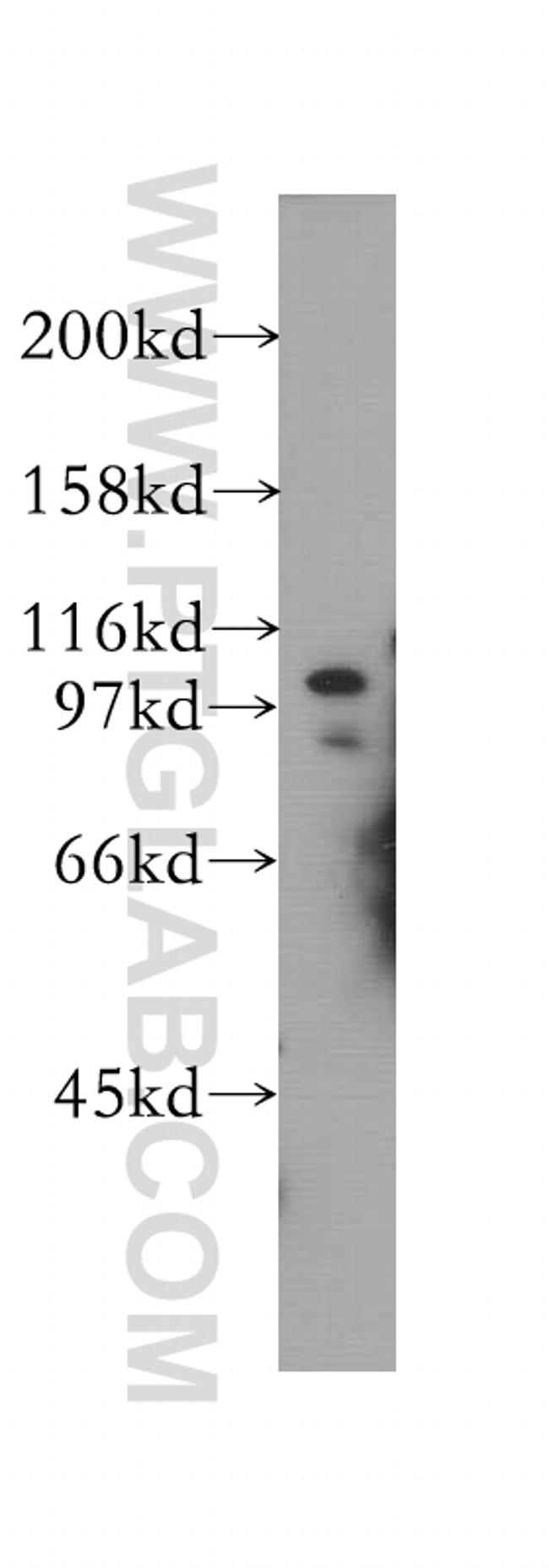 SMARCAL1 Antibody in Western Blot (WB)