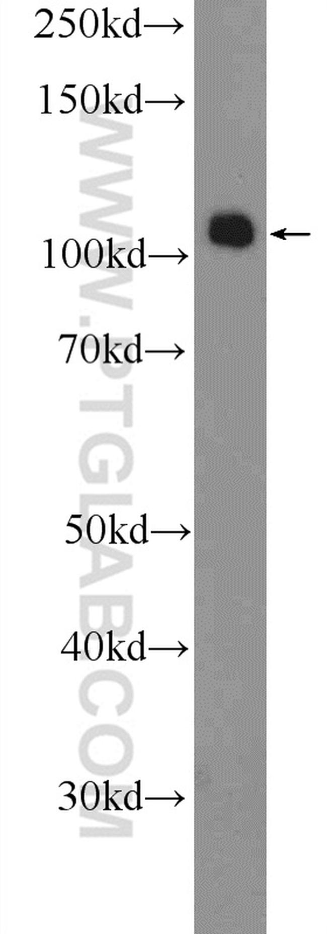 SMARCAL1 Antibody in Western Blot (WB)