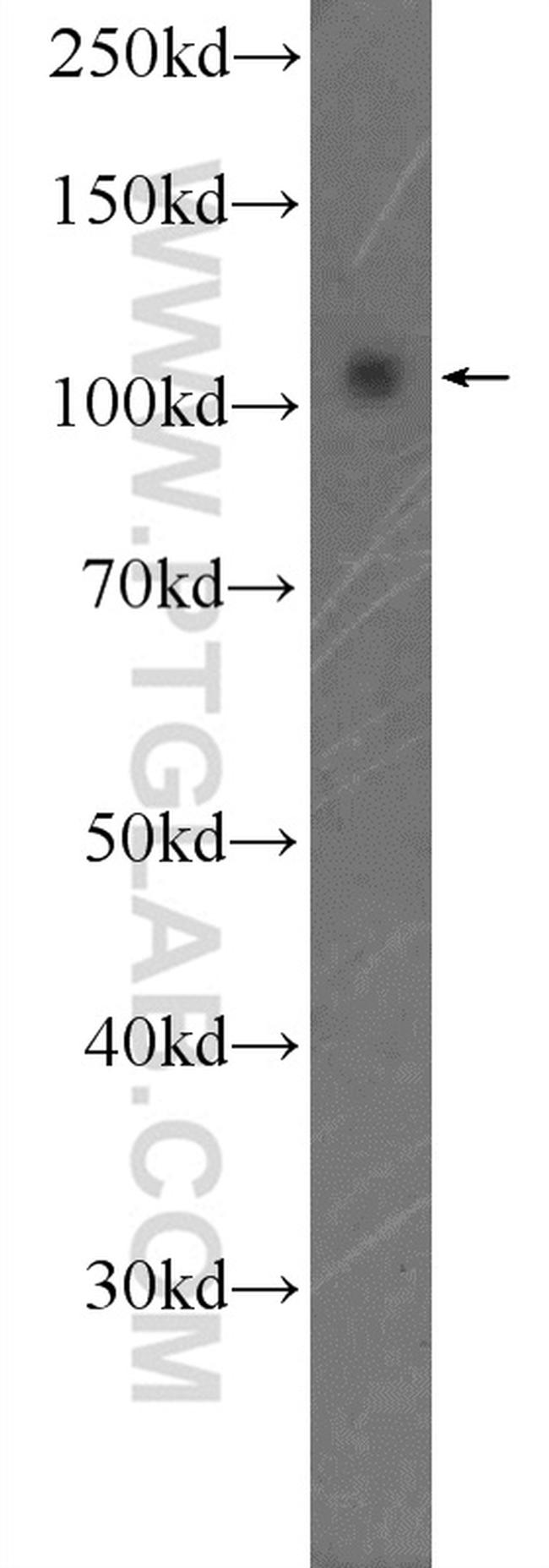 SMARCAL1 Antibody in Western Blot (WB)