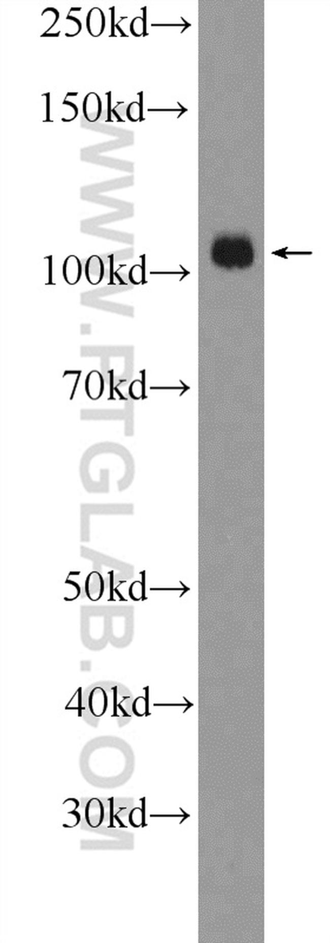 SMARCAL1 Antibody in Western Blot (WB)