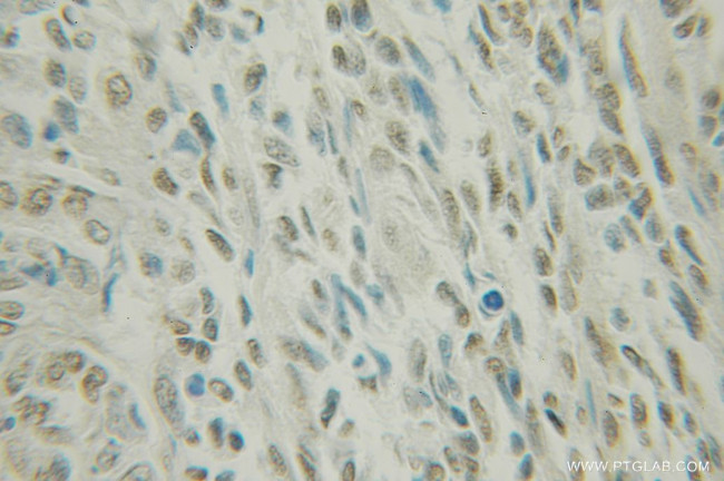 NUFIP1 Antibody in Immunohistochemistry (Paraffin) (IHC (P))