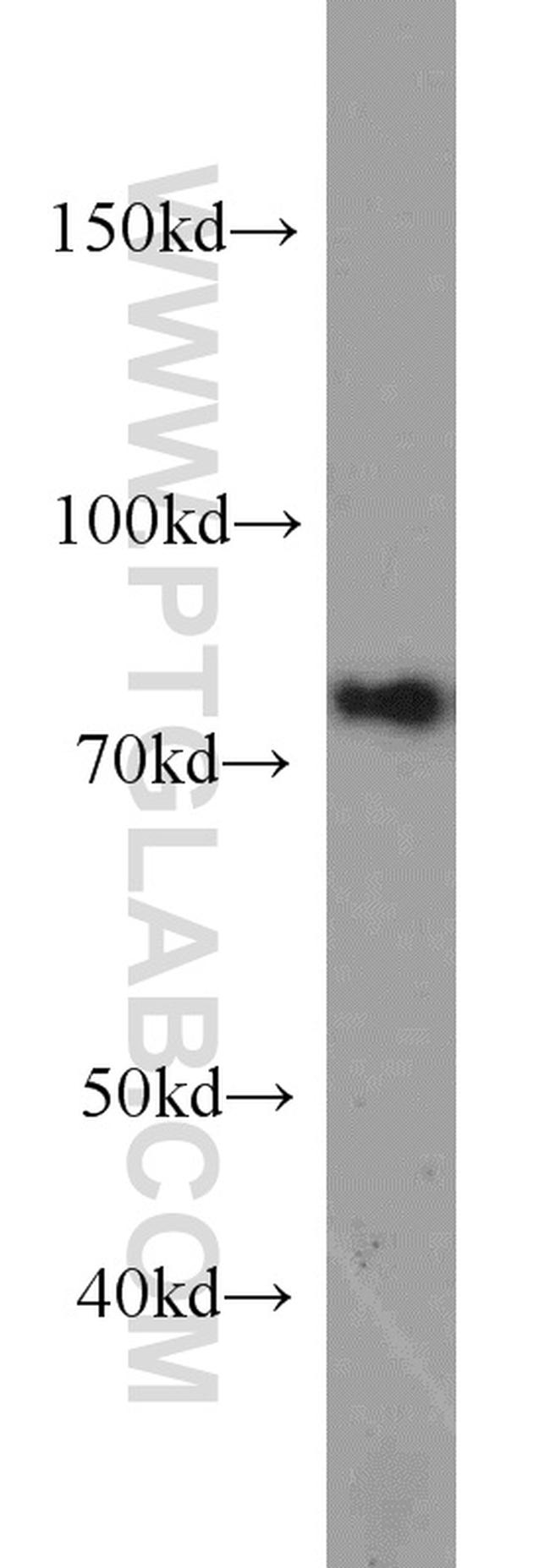 NUFIP1 Antibody in Western Blot (WB)