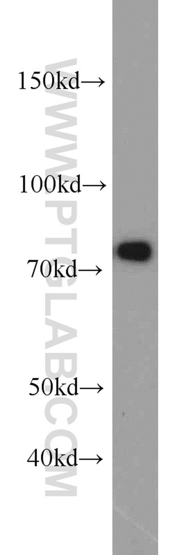 NUFIP1 Antibody in Western Blot (WB)