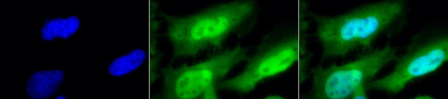 HSF1 Antibody in Immunocytochemistry (ICC/IF)