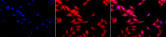 HSF1 Antibody in Immunocytochemistry (ICC/IF)