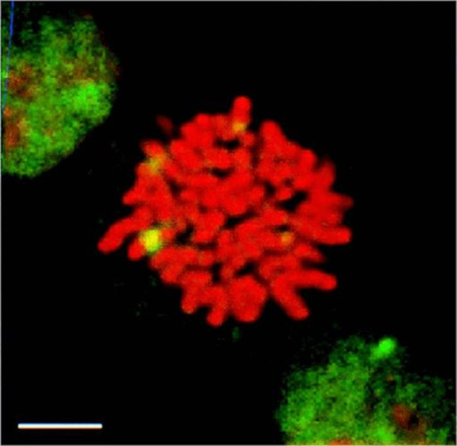 HSF1 Antibody in Immunocytochemistry (ICC/IF)