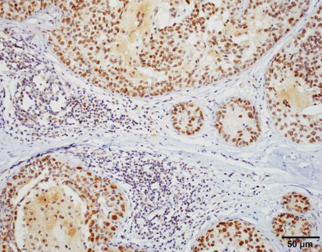 HSF1 Antibody in Immunohistochemistry (PFA fixed) (IHC (PFA))