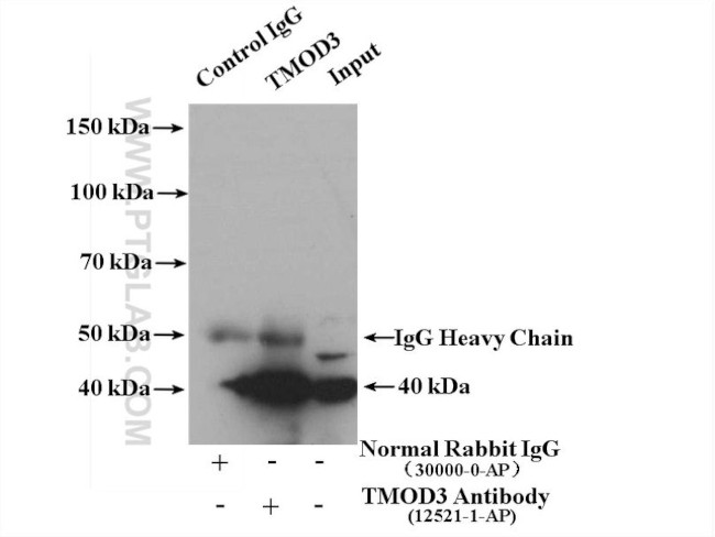 TMOD3 Antibody in Immunoprecipitation (IP)