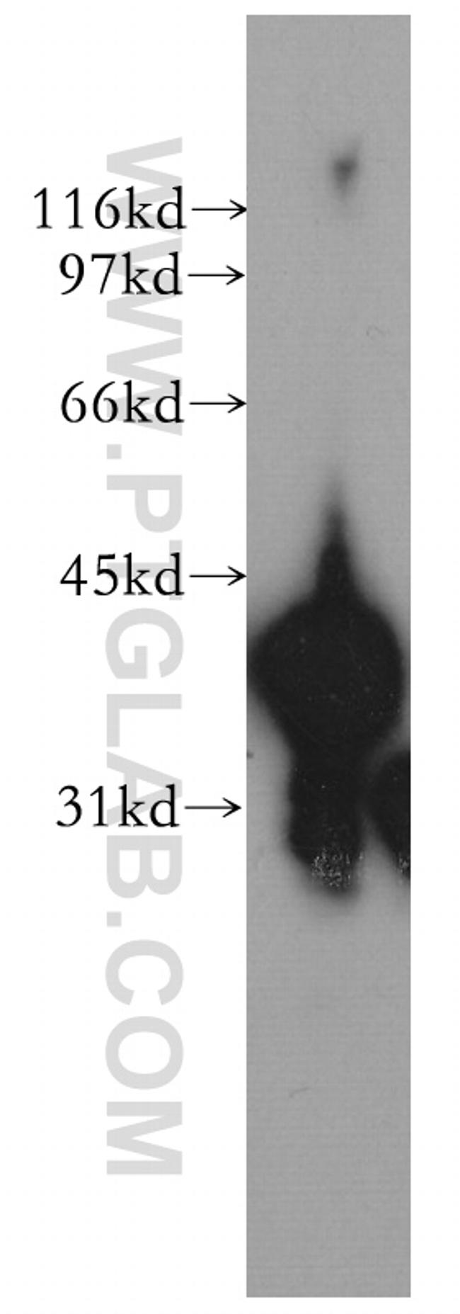 TMOD3 Antibody in Western Blot (WB)