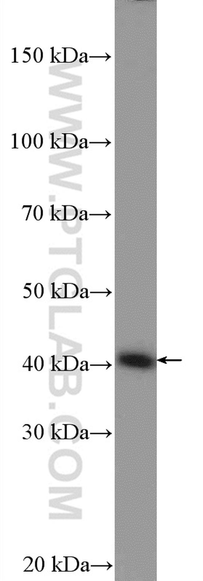 TMOD3 Antibody in Western Blot (WB)