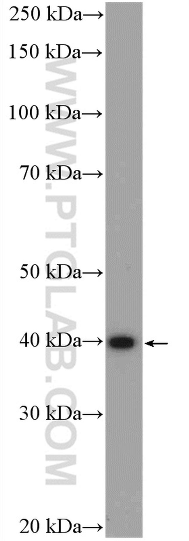 TMOD3 Antibody in Western Blot (WB)