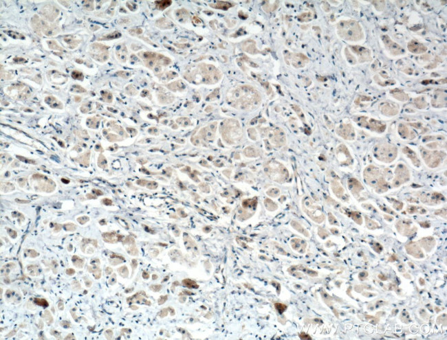 SULT1E1 Antibody in Immunohistochemistry (Paraffin) (IHC (P))