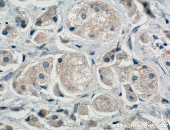 SULT1E1 Antibody in Immunohistochemistry (Paraffin) (IHC (P))