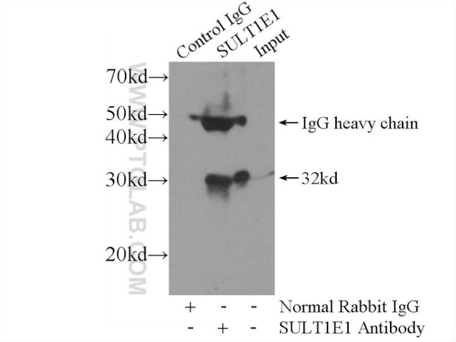 SULT1E1 Antibody in Immunoprecipitation (IP)