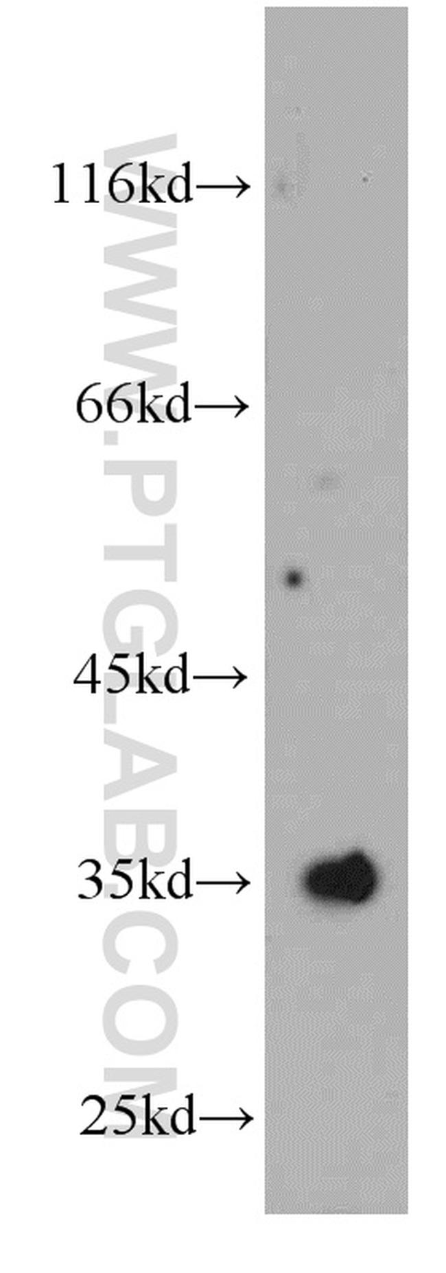 SULT1E1 Antibody in Western Blot (WB)