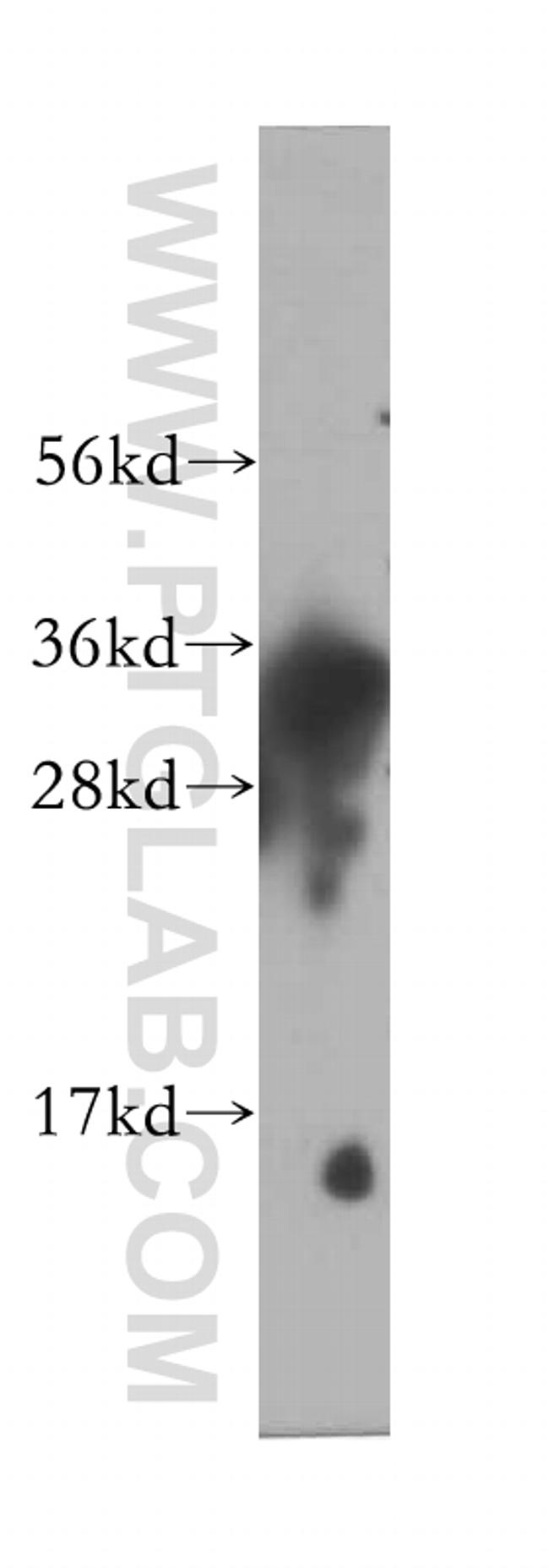 SULT1E1 Antibody in Western Blot (WB)