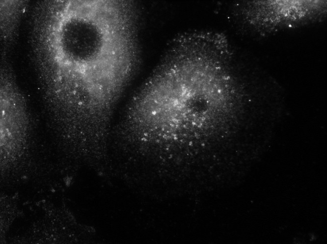 CHMP2B Antibody in Immunocytochemistry (ICC/IF)