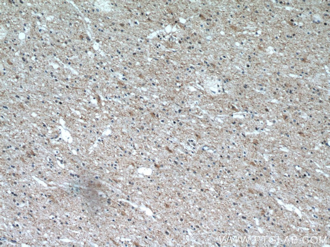 CHMP2B Antibody in Immunohistochemistry (Paraffin) (IHC (P))