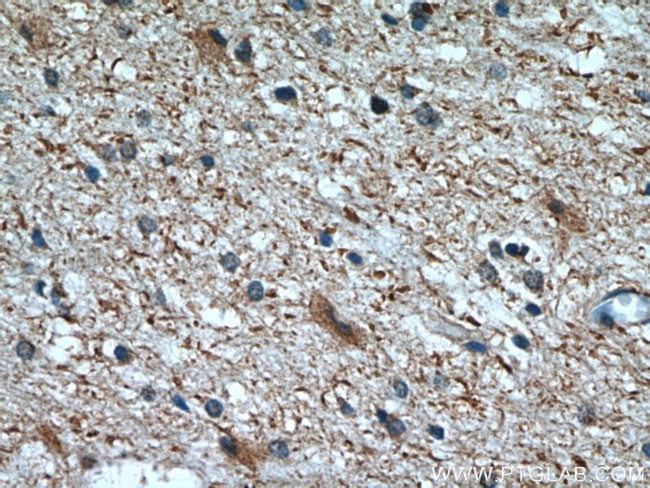 CHMP2B Antibody in Immunohistochemistry (Paraffin) (IHC (P))