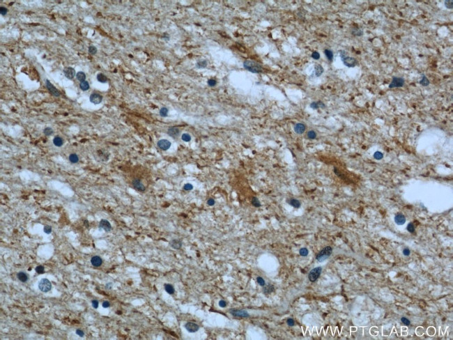 CHMP2B Antibody in Immunohistochemistry (Paraffin) (IHC (P))