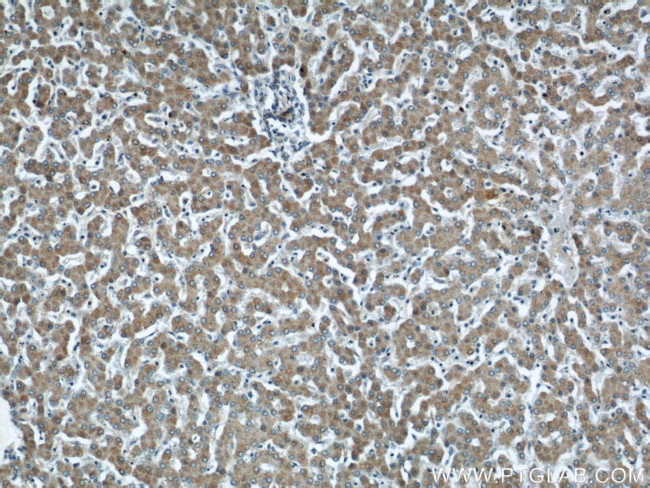 CHMP2B Antibody in Immunohistochemistry (Paraffin) (IHC (P))