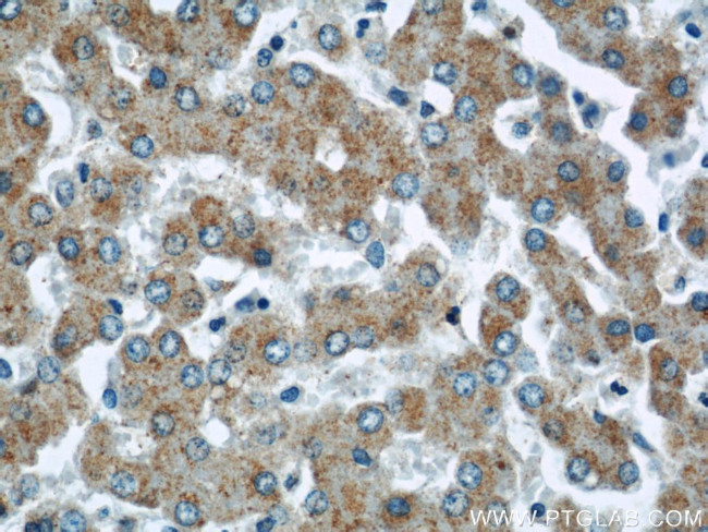 CHMP2B Antibody in Immunohistochemistry (Paraffin) (IHC (P))