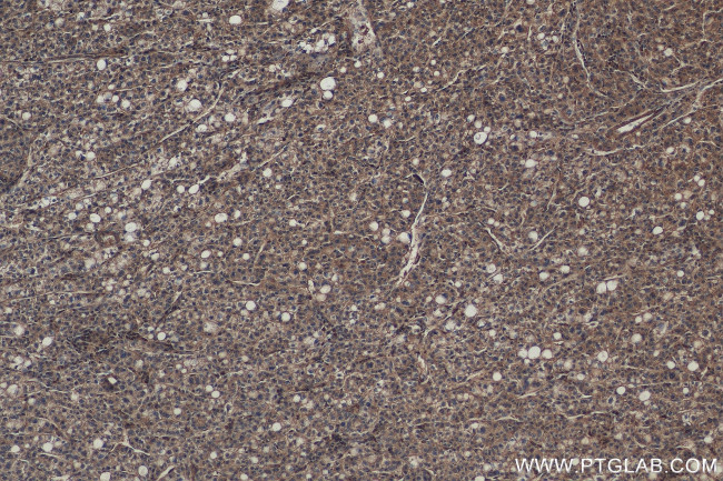 CHMP2B Antibody in Immunohistochemistry (Paraffin) (IHC (P))