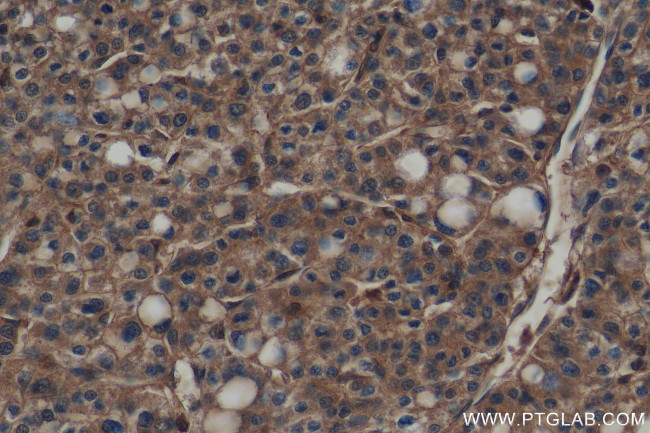 CHMP2B Antibody in Immunohistochemistry (Paraffin) (IHC (P))