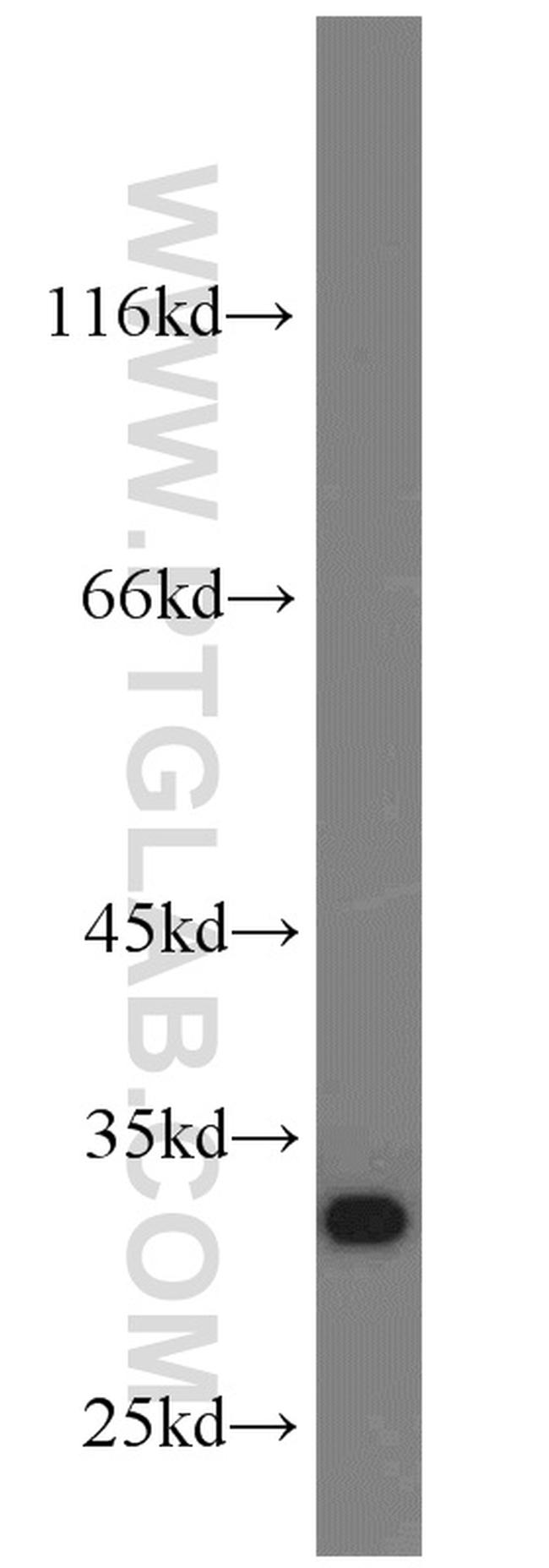 CHMP2B Antibody in Western Blot (WB)