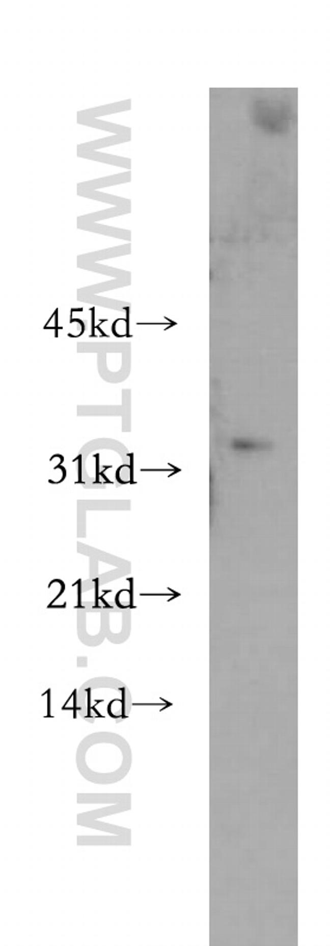 CHMP2B Antibody in Western Blot (WB)