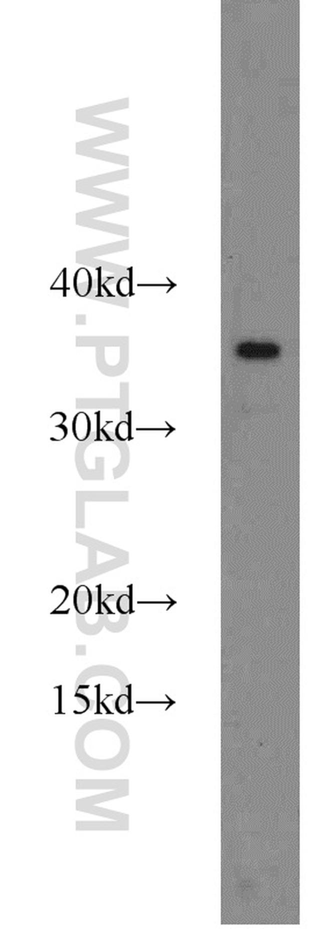 CHMP2B Antibody in Western Blot (WB)