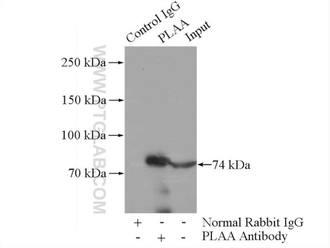 PLAA Antibody in Immunoprecipitation (IP)