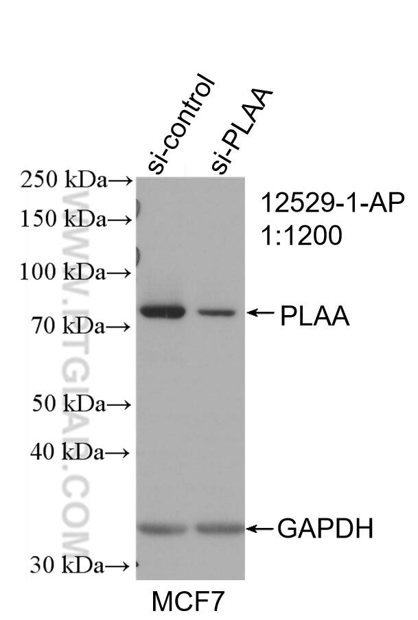 PLAA Antibody in Western Blot (WB)