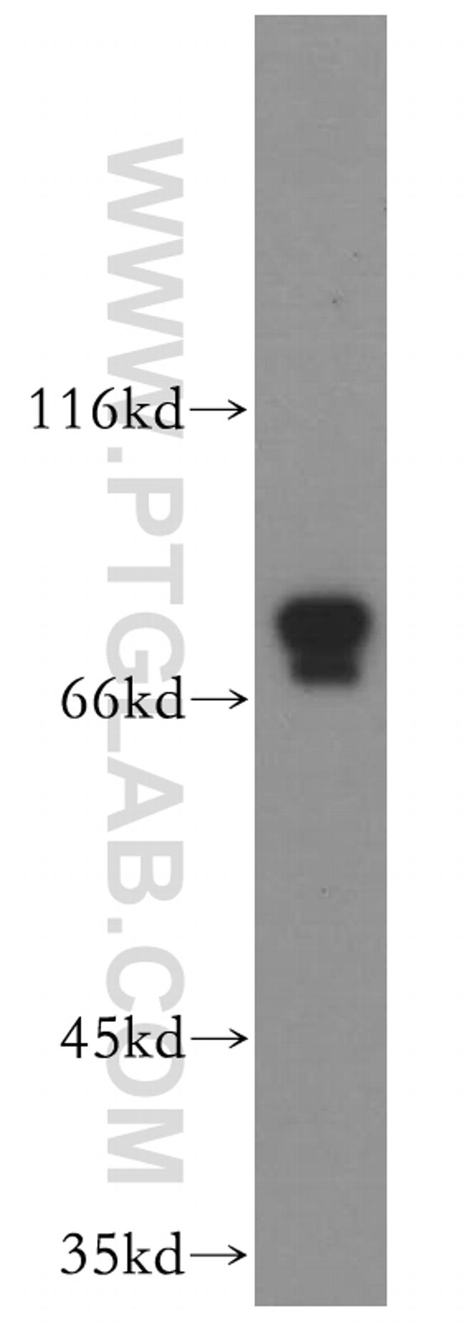PLAA Antibody in Western Blot (WB)