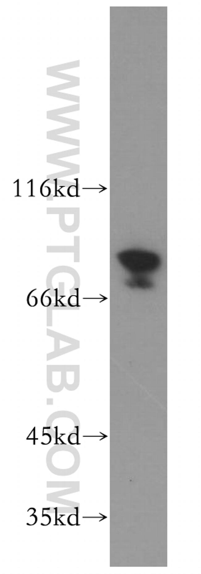 PLAA Antibody in Western Blot (WB)