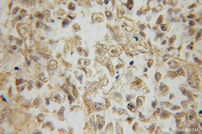 RRAS2 Antibody in Immunohistochemistry (Paraffin) (IHC (P))