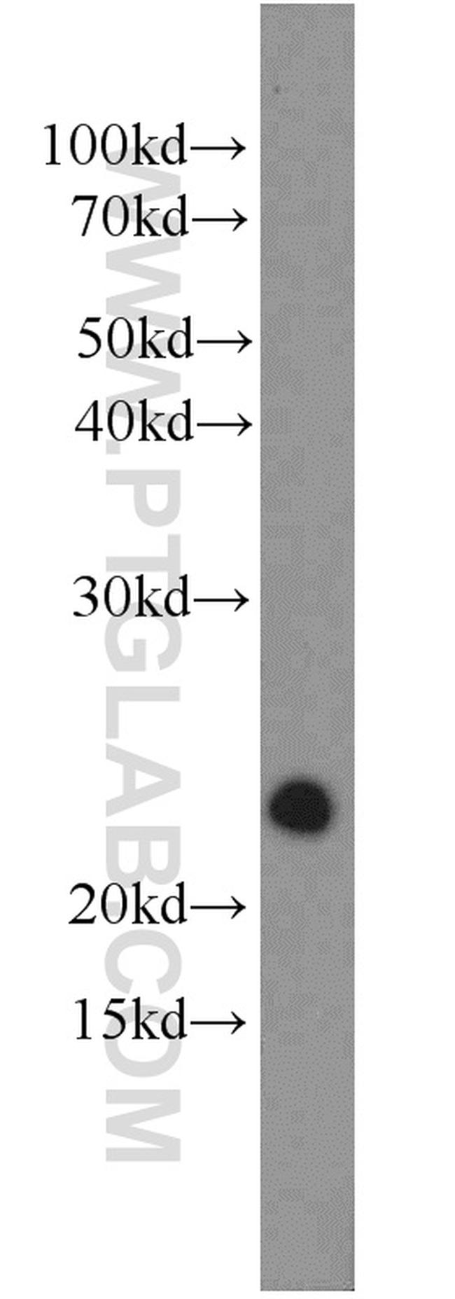 RRAS2 Antibody in Western Blot (WB)