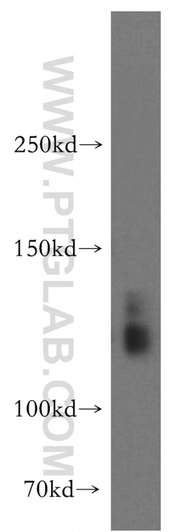 SLC4A8 Antibody in Western Blot (WB)