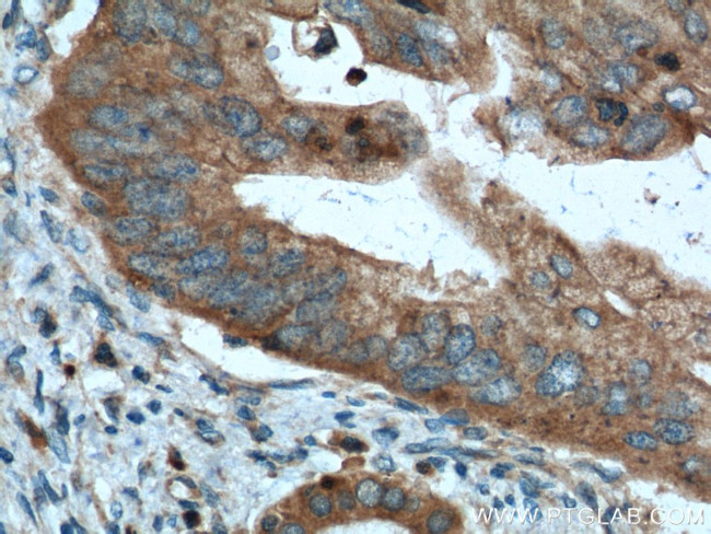 Amylase alpha Antibody in Immunohistochemistry (Paraffin) (IHC (P))