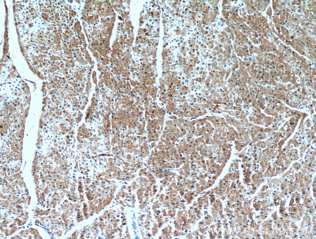 PIP5K1B Antibody in Immunohistochemistry (Paraffin) (IHC (P))