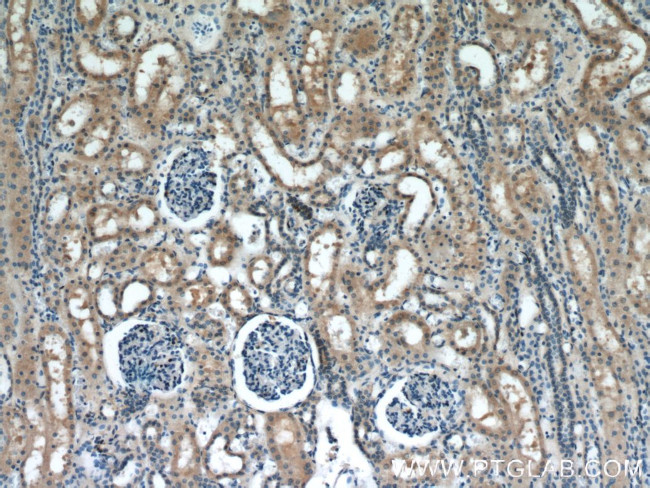 PIP5K1B Antibody in Immunohistochemistry (Paraffin) (IHC (P))