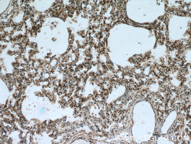 PIP5K1B Antibody in Immunohistochemistry (Paraffin) (IHC (P))