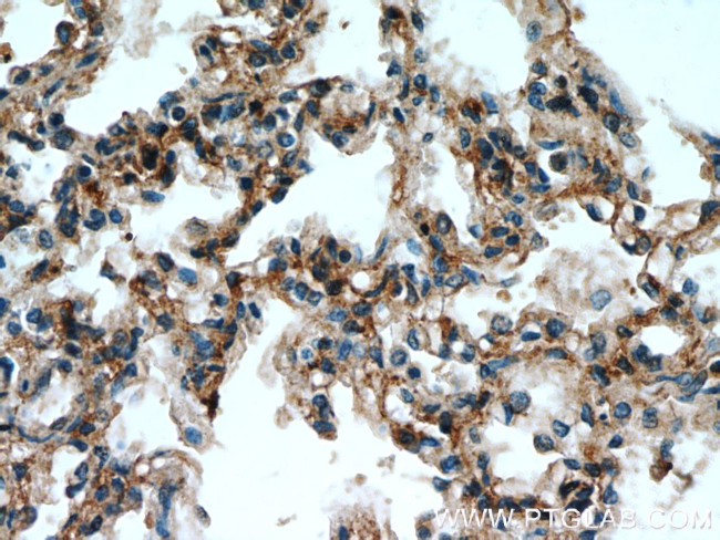 PIP5K1B Antibody in Immunohistochemistry (Paraffin) (IHC (P))