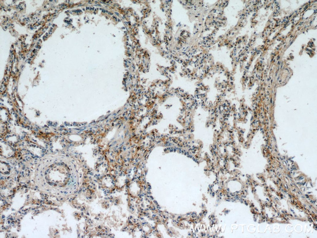 PIP5K1B Antibody in Immunohistochemistry (Paraffin) (IHC (P))