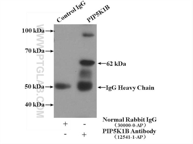 PIP5K1B Antibody in Immunoprecipitation (IP)