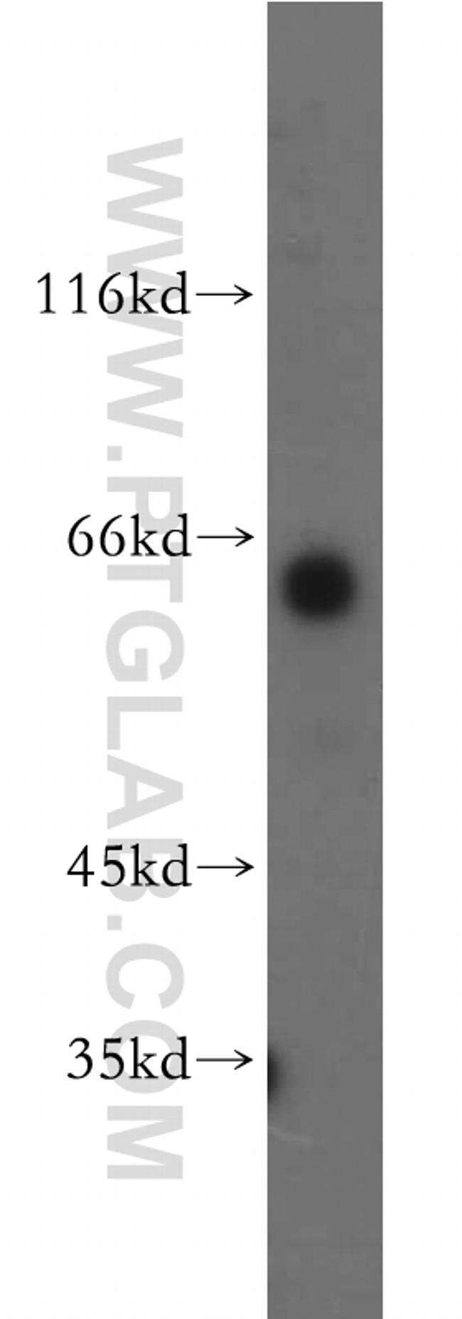 PIP5K1B Antibody in Western Blot (WB)