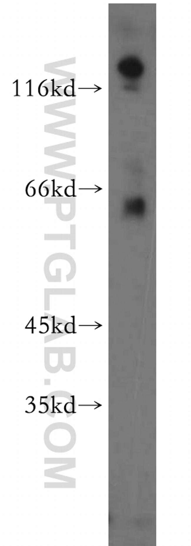 PIP5K1B Antibody in Western Blot (WB)