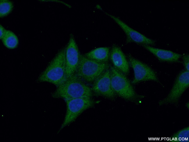 Annexin VI Antibody in Immunocytochemistry (ICC/IF)