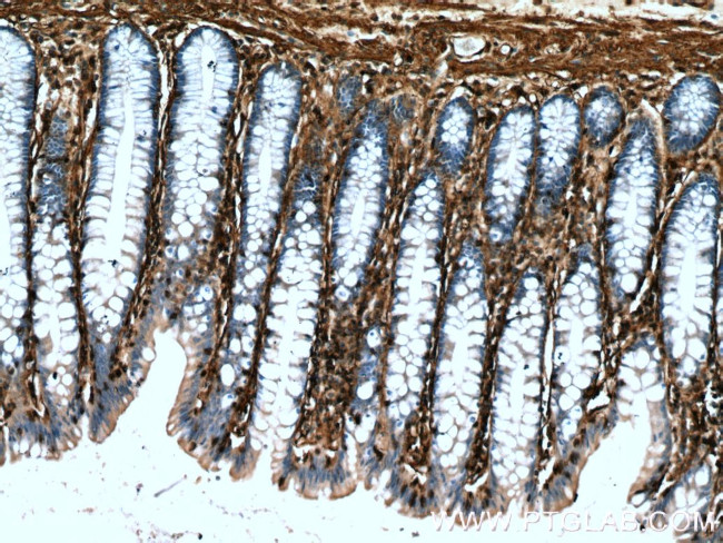 Annexin VI Antibody in Immunohistochemistry (Paraffin) (IHC (P))