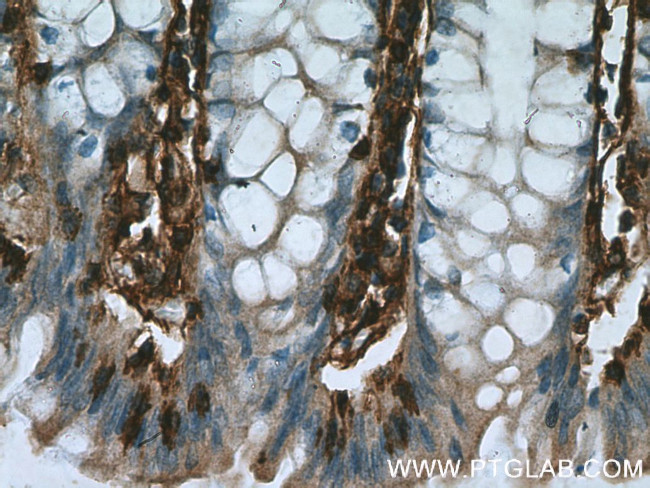 Annexin VI Antibody in Immunohistochemistry (Paraffin) (IHC (P))